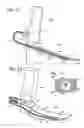 Fig. 08 - Intubation systems and methods based on airway pattern identification