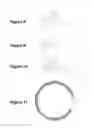 Fig. 05 - Tracheostomy guard