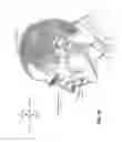 Fig. 09 - Patient interface