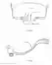 Fig. 16 - Patient interface