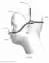 Fig. 20 - Patient interface
