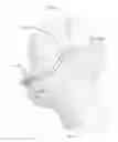 Fig. 27 - Patient interface