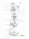 Fig. 31 - Patient interface