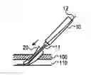 Fig. 01 - Devices and methods for endovascular access and therapy