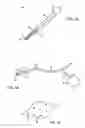 Fig. 02 - Devices and methods for endovascular access and therapy