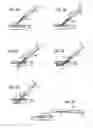 Fig. 03 - Devices and methods for endovascular access and therapy