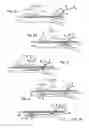 Fig. 04 - Devices and methods for endovascular access and therapy