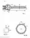 Fig. 12 - Devices and methods for endovascular access and therapy