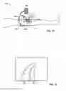 Fig. 17 - Devices and methods for endovascular access and therapy