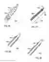Fig. 25 - Devices and methods for endovascular access and therapy