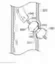 Fig. 01 - Devices for delivering substances through an extra-anatomic opening created in an airway