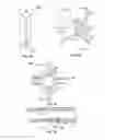 Fig. 07 - Devices for delivering substances through an extra-anatomic opening created in an airway