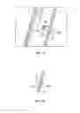 Fig. 17 - Devices for delivering substances through an extra-anatomic opening created in an airway