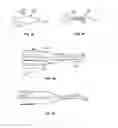 Fig. 19 - Devices for delivering substances through an extra-anatomic opening created in an airway