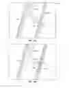 Fig. 20 - Devices for delivering substances through an extra-anatomic opening created in an airway