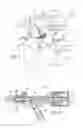 Fig. 05 - Hemostasis valve for guide catheter control
