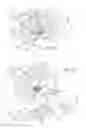 Fig. 12 - Hemostasis valve for guide catheter control