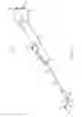 Fig. 02 - Balloon dilation catheter for use in sinus passageways
