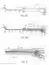 Fig. 04 - Balloon dilation catheter for use in sinus passageways
