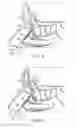 Fig. 08 - Balloon dilation catheter for use in sinus passageways
