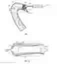 Fig. 02 - Perfusion catheters and related methods