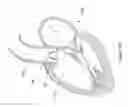 Fig. 131 - INFLATABLE MEDICAL DEVICES