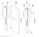 Fig. 49 - INFLATABLE MEDICAL DEVICES