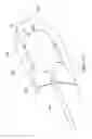Fig. 85 - INFLATABLE MEDICAL DEVICES