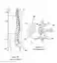 Fig. 90 - INFLATABLE MEDICAL DEVICES