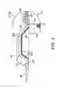 Fig. 07 - Swallowable drug delivery device and methods of drug delivery