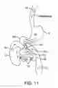 Fig. 18 - Swallowable drug delivery device and methods of drug delivery