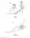 Fig. 02 - Needleless valve infection prevention and pre-opening device