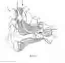 Fig. 02 - External and implantable coils for auditory prostheses