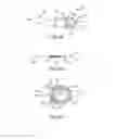 Fig. 06 - External and implantable coils for auditory prostheses
