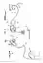 Fig. 02 - Implantable Magnet Arrangements