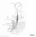 Fig. 04 - CATHETER SYSTEM CANNULA
