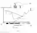 Fig. 02 - METHOD OR APPARATUS FOR WRINKLE TREATMENT