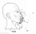 Fig. 04 - FILTERING FACE RESPIRATOR HAVING OPTIMIZED FACIAL FILTER LOCATION