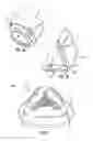 Fig. 07 - FILTERING FACE RESPIRATOR HAVING OPTIMIZED FACIAL FILTER LOCATION