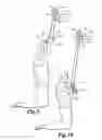 Fig. 06 - TRANSPORTABLE EXERCISE DEVICE MUSCLE UP TRAINER