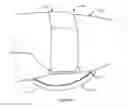 Fig. 06 - Rehabilitation and mobility improvement apparatus and method of use