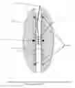 Fig. 01 - Computerized yo-yo