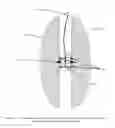 Fig. 12 - Computerized yo-yo