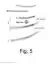Fig. 06 - Exclusion zone filtration