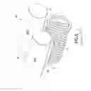 Fig. 06 - FLOATING SUCTION HEAD ASSEMBLY