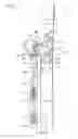 Fig. 02 - Bleeder cord affixing device and method