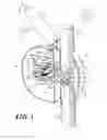 Fig. 06 - Cutting apparatus and associated systems