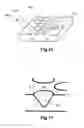 Fig. 09 - TIRE COMPRISING A HIGH CONTRAST MATRIX SYMBOL ON THE SIDEWALL THEREOF