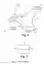 Fig. 03 - Suspension control arm with frangible bushing collar