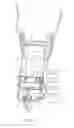 Fig. 08 - Method of producing a lumbar support device, lumbar support device and vehicle seat